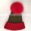 Myfur Adult Woolen Hat Bi-color Fox Body Fur Pom Poms Knitting Beanie Hat