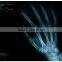8*10in(20*25cm)clear image quality medical x-ray film compatible knd & fuji & agfa