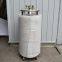 30L Self-pressure Cryogenic transport liquid nitrogen tank for cryotherapy