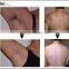 New upgraded Vertical best effective soprano laser hair removal machine/alexandrite laser hair removal machine (CE,TUV)
