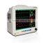 CE approved 6 parameter 12 inch Patient Monitor Wifi thermal recorder ETCO2 IBP optional