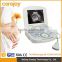 Widely used Digital Portable Ultrasound Scanner Suitable for the diagnosis of Abdomen, Cardiac, Gynecology, Obstetrics