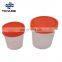 30ml 40ml 60ml Lab Sterile Plastic Urine Sample Specimen Collection Container