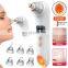 Visual Blackhead Remover Camera LCD Electric Vacuum Heating Pore Cleaner Acne Removal Blackhead Extractor