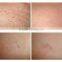 Professional 10Hz super hair removal portable ipl machine