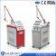 Best Tattoo Removal Laser Equipment Freckles Pigment Age Spots Removal Beauty Machine