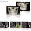 MY-D065 medical tomography cbct dental x ray digital panoramic x-ray equipment