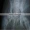 Fuji Medical Films Medical X Ray Film thermal dry film made in china the most popular film