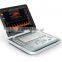 MC-DU-C5 Laptop Color Doppler Ultrasound System SonoScape 4d ultrasound promotion product