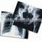 Agfa fuji film new product hospital can use medical digital film classsical film