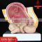 Pregnancy pelvis with mature fetus 2 parts