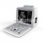 Medical Ultrasound Instruments 12 inch Portable Full Digital 2D/3D/4D Ultrasound Machine for Hospital use