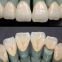 Chinese Dental Laboratory Nobel PFM Crown (Porcelain Fused To Metal)