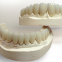 Robust Zirconia Crowns & Bridge