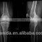 blue dry X Ray medical Film/cheap films the most popular film