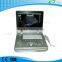 LTC5 medical clinic PC Based color doppler Laptop Ultrasound equipment