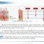 New Powerful hair removal system AFT IPL SHR