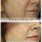 Beauty salon equipment professional diamond water dermabrasion machines