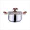 The Most Popular Stainless Steel Cookware Set