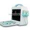 Laptop 3D/4D color doppler ultrasound & portable color doppler ultrasound scanner