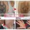 New Portable 1064nm & 532nm Q Switch ND Yag Laser Tattoo Removal Machine