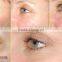 Notime 2016 eye wrinkle eraser pen microcurrent therapy devices