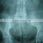 new products dt2b/diht medical x ray films