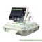 (Medical,Clinic)New doppler fetal baby monitor with CE approved - MSLDM02