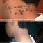 New design in 2016 nd yag laser alexandrite laser tattoo removal laser from china