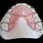 Dental Lab Mk1 Precision Attached Dentures Are Beautiful And Natural