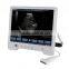 B Mode Portable Ultrasound Price TS20