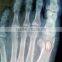China KND-A/F CE medical dry film agfa healthcare