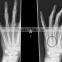 2015 new hot blue film blue film without cloths Medical x-ray blue film thermal dry film for hospital