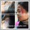 1000W Best Q-switch Nd: Yag Laser Tattoo Removal Machine / 1500mj Q Switch Nd Yag Laser Pigment Removal System For Sale