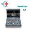 Cheap medical Sonoscape x3 ultrasound machine/Laptop ultrasound scanner/Portable ultrasound probe