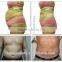 lipo laser dual wavelength 650nm 980nm lipo laser/lipo laser machine fda approved