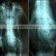 KENID xray film used on medical thermal printers high quality
