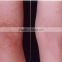 scar sheet silicone gel sheet deep scar removal of many sizes
