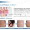 40W RF Excited Fractional Co2 Surgical Laser Vaginal Rejuvenation / Stretch Marks Removal / Laser Vaginal Tightening