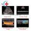 Best-selling Trolley Mindray dc-40 color doppler ultrasound machine portable Mindray ultrasound device