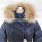 women coat korean, women jacket winter, long coat for ladies