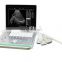 China made portable doppler ultrasound scanner machine Laptop ultrasound