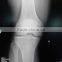 medical surgical film x ray film fuji diht for hospital use fuji diht 14x17                        
                                                Quality Choice