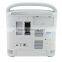 LED rotatable Ultrasound Scanner with 2.5-5.0MHz Convex probe USB VGA Video LAN port CE ISO approved