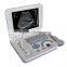 Hospital Full-digital Cheap Battery Diagnosis Equipment Laptop Ultrasound 3018