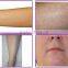 2016GLM SHR808 (LDS600) User Manual L-9 System hair removal with CE for sale