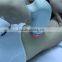 Portable Diode Laser machine for permanently removing all color of hair