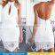 New Style Fashion Sexy Women Clothing Lace Stiching Sheath Dresses