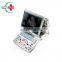 DP-50 Original Mindray dp 50 refurbished ultrasound device portable ultrasonic diagnosis dp50 system