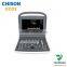 ECO2 high image quality good price black and white portable ultrasound Chison